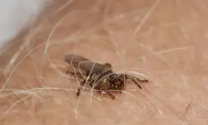 Mały, ciemny owad z przezroczystymi skrzydłami, przypominający latające kleszcze, siedzi wśród jasnych włosków na skórze.