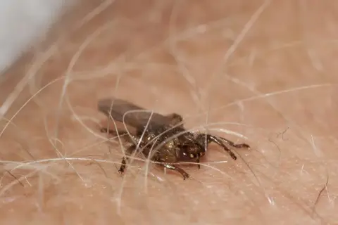 Mały, ciemny owad z przezroczystymi skrzydłami, przypominający latające kleszcze, siedzi wśród jasnych włosków na skórze.