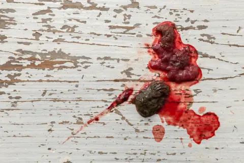 Kupa psa z krwią i fragmentami tkanki na białej, popękanej powierzchni.