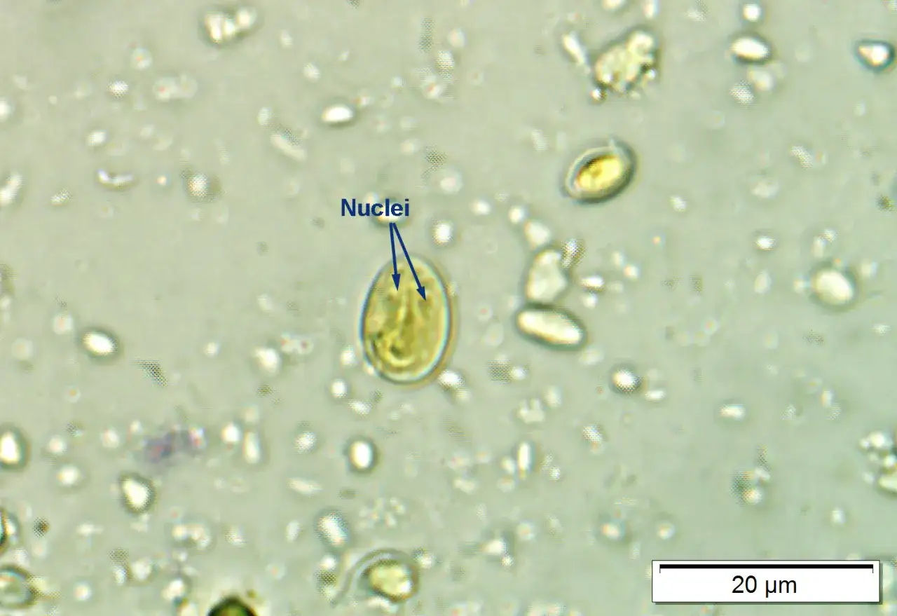 Widok mikroskopowy cyst Giardia u psa. Widać owalne cysty z widocznymi jądrami. Skala 20 µm.